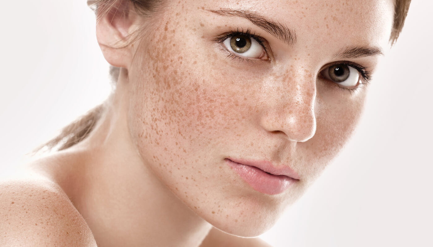 freckless.jpg